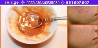 მოიშორეთ სახეზე არსებული ნაწიბურები და ლაქები ამ ნიღბით!