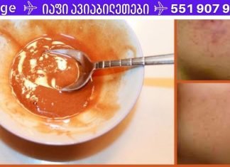 მოიშორეთ სახეზე არსებული ნაწიბურები და ლაქები ამ ნიღბით!