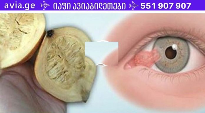 გადაააგდეთ სათვალეები! ეს ხელსაწყო 80%-ით აღადგენს თქვენს ხედვას!