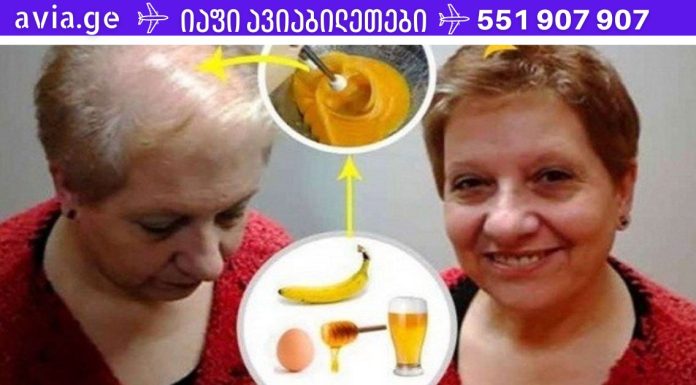 რეცეპტი თმის უკეთესი ზრდისთვის: ექიმები შოკში არიან მისი ეფექტით!