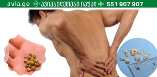 ეს უნდა იცოდეთ.წელის ტკივილი ,თირკმელში კენჭის არსებობის სიმპტომი შეიძლება იყოს