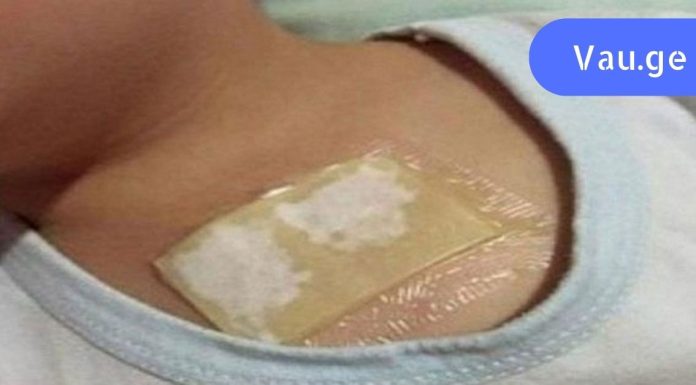ხსნის ძლიერ ხველას და შლის ლორწოს ფილტვებიდან და ბრონქებიდან სულ რაღაც 1 ღამეში: ეს არის ხსნა.