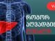 თქვენს ყურადღებას მივიქცევთ 10 ყველაზე სასარგებლო საკვებით , ღვიძლისთვის, რომელიც თქვენი ყოველდღიური რაციონის განუყოფელი ნაწილი უნდა გახდეს.